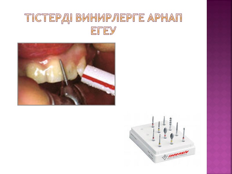 Тістерді винирлерге арнап егеу